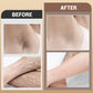 Gentle Hair Removal Cream—suitable for multiple body parts
